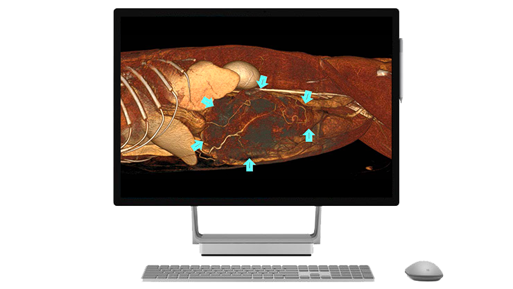 Graphics-EAH_VoxelVu_WorkStation_1_Feline_Colonic_Mass